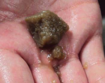 301.有機(jī)物污染后的樹脂 .jpg